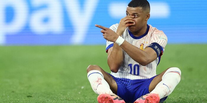 Akankah Kylian Mbappe bermain di Belanda vs Prancis di Euro 2024 setelah patah hidung