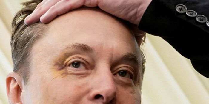 Berita Mata Elon Musk Lebam saat Muncul di Gedung Putih usai Resign, Ada Apa?