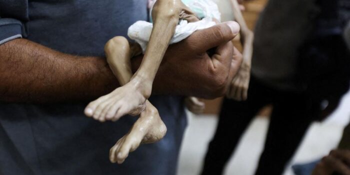 Berita Kondisi Tragis Bayi Zainab Wafat Malnutrisi Saat Israel Blokir Gaza
