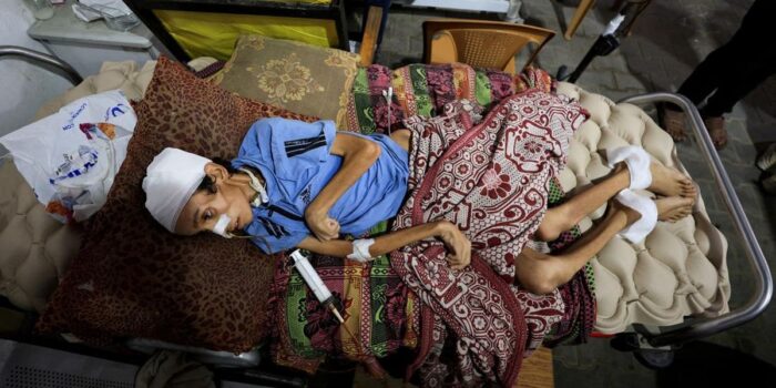 Berita Gaza Darurat Kelaparan hingga Kematian Akibat Kekejian Israel
