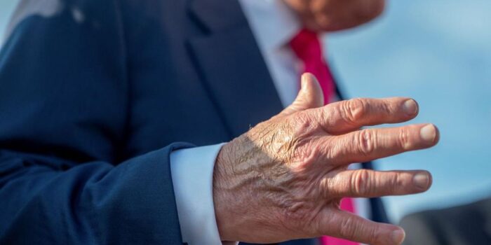Berita Tutupi Memar Pakai Makeup, Trump Mau Sembunyikan Penyakit?