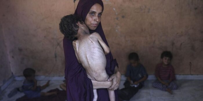 Berita Anak-anak Korban Genosida Sistematis Israel, Dibuat Kelaparan