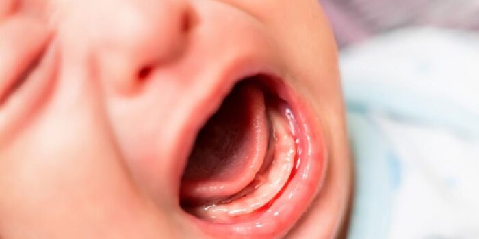Berita Balita Luka Diduga Digigit di Daycare, Orang Tua Lapor Polisi
