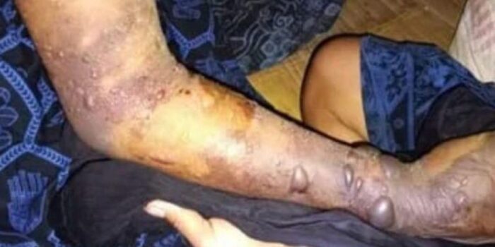 Berita 7 Warga Badui Meninggal Akibat Gigitan Ular Tanah