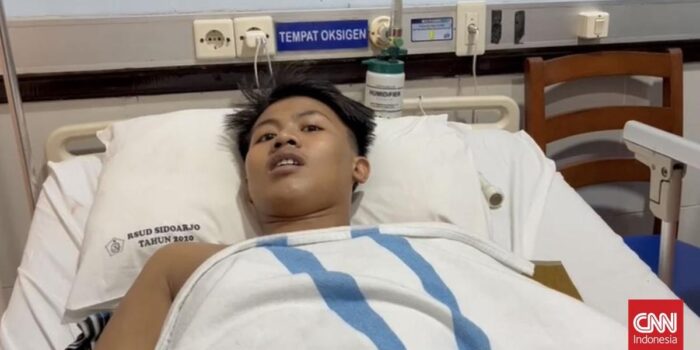 Berita Kisah Nur Ahmad, Santri yang Kehilangan Lengan di Tragedi Al Khoziny