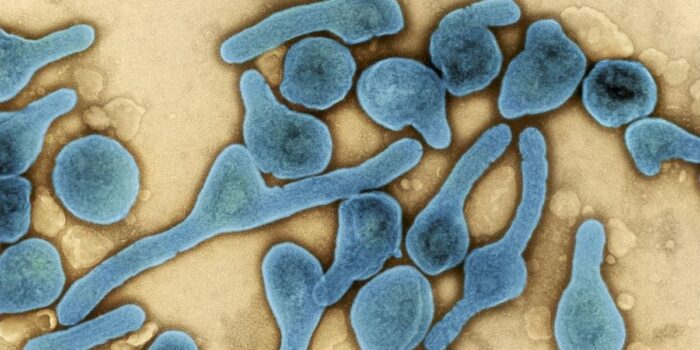 Berita Ethiopia Konfirmasi ‘Outbreak’ Pertama Virus Marburg Berita Ethiopia Konfirmasi ‘Outbreak’ Pertama Virus Marburg